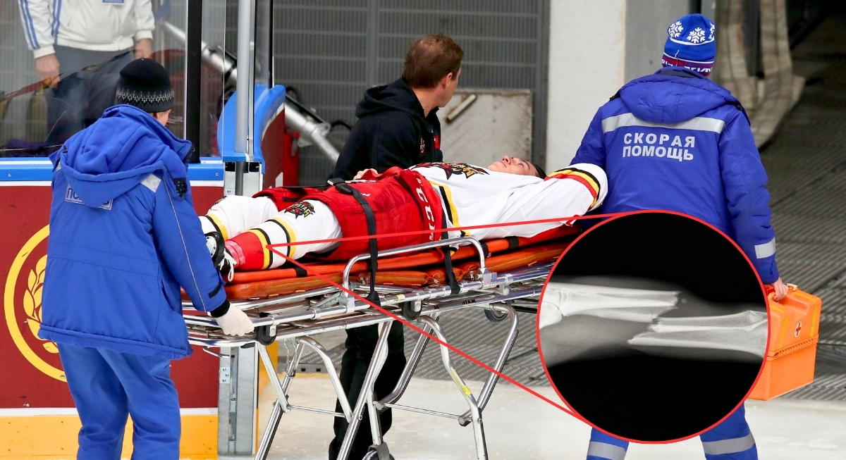 The 17 Most BRUTAL Injuries in NHL History - AOL