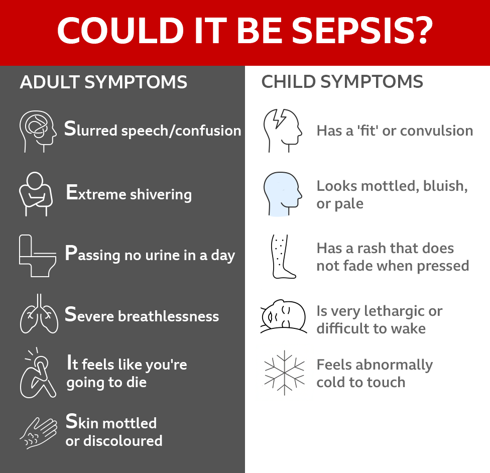 Parents offer bereavement help after sepsis death - AOL