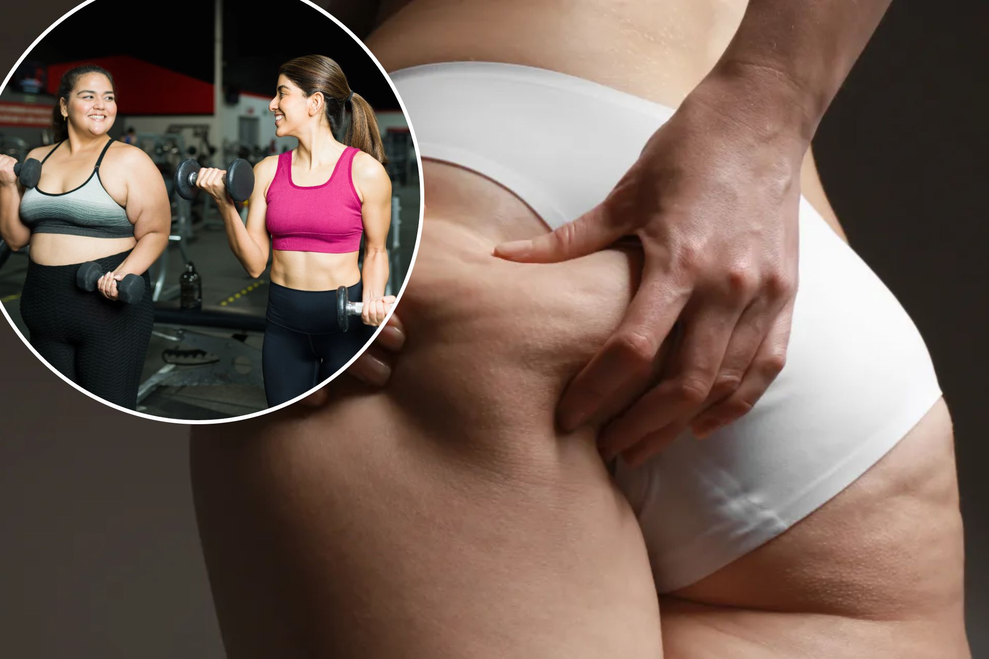 New drug could fight 'Ozempic butt' — and some other unwelcome side effects of GLP-1 drugs