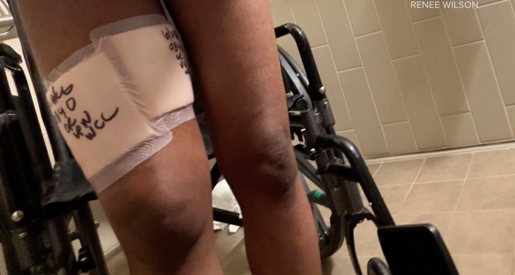 Horrifying moment pregnant woman is attacked by dogs — as doctors ...