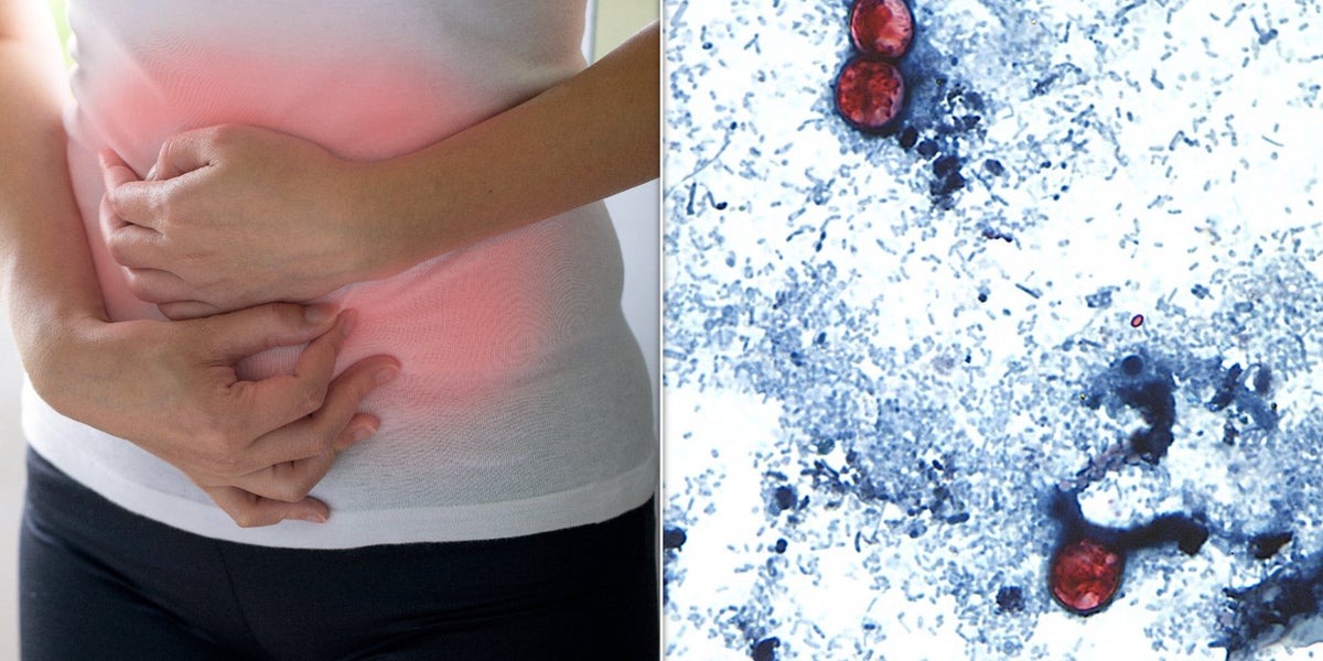 New Photo - The Key Difference Between Regular Diarrhea And Cyclosporiasis, The Summer’s Explosive Diarrhea Illness