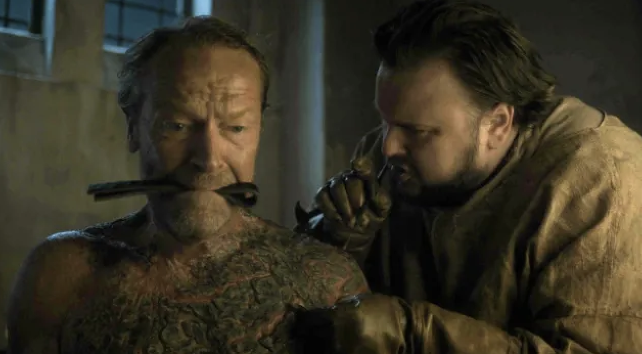 A cena em que Sam Tarly remove a escala de cinza de Jorah Mormont em Game of Thrones foi um momento de revirar o estômago. Assistir Sam descascar cuidadosamente a pele infectada, revelando camadas de crostas e pus por baixo, foi o suficiente para fazer até os espectadores mais fortes se sentirem enjoados. E embora os efeitos horríveis tenham sido criados com próteses, filmar a cena ainda estava longe de ser agradável. John Bradley, que interpretou Sam, se abriu sobre a filmagem da cena e admitiu que o realismo dos efeitos tornou difícil ignorá-la.
