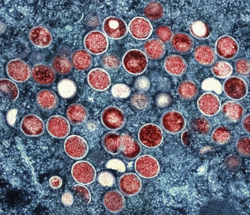 RI health experts warn of uptick in mpox, but risk still low to public