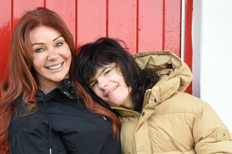 Billy Caldwell turns 21 - the boy who legalised medicinal cannabis in Britain