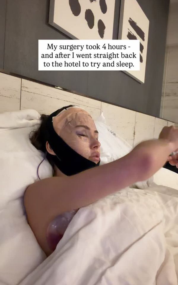New Photo - Influencer Says Post-Cosmetic Surgery Swelling Was So Bad Her iPhone Didn’t Recognize Her