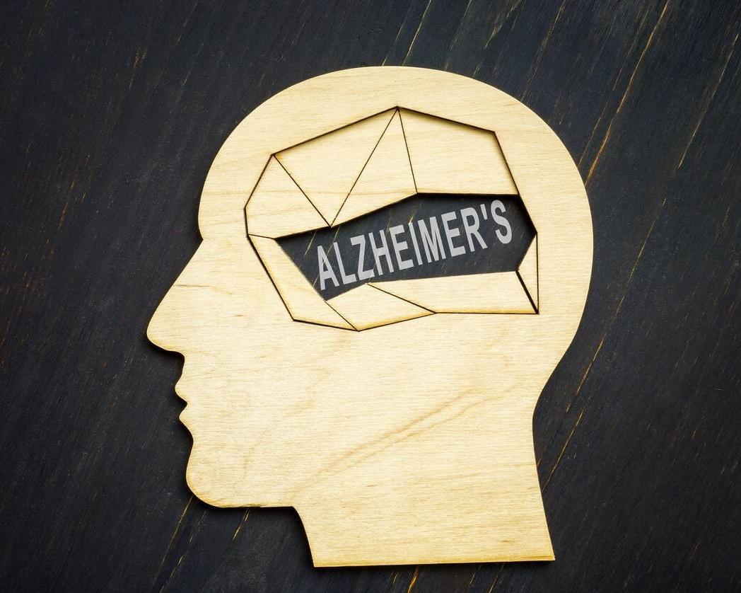Alzheimer's trial to test drug on people without symptoms to see if it can be prevented
