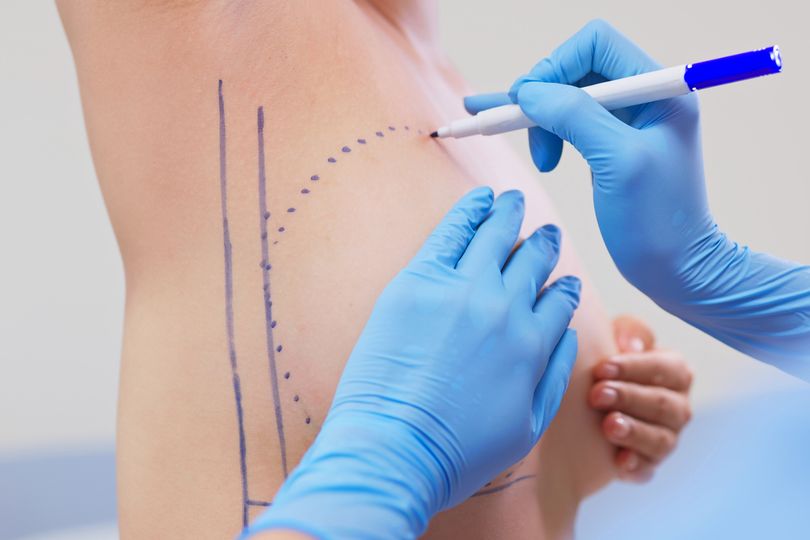 'My older girlfriend says that she wants a second boob job'
