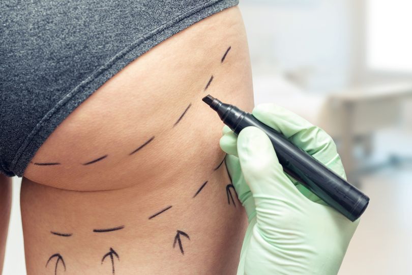 Delay in action on cosmetic procedures 'prolonging risk to public safety', warn MPs