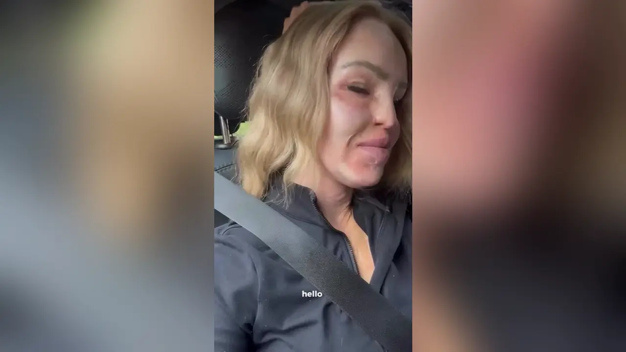 Katie Piper reveals cruel comments she received from trolls after her NTAs appearance