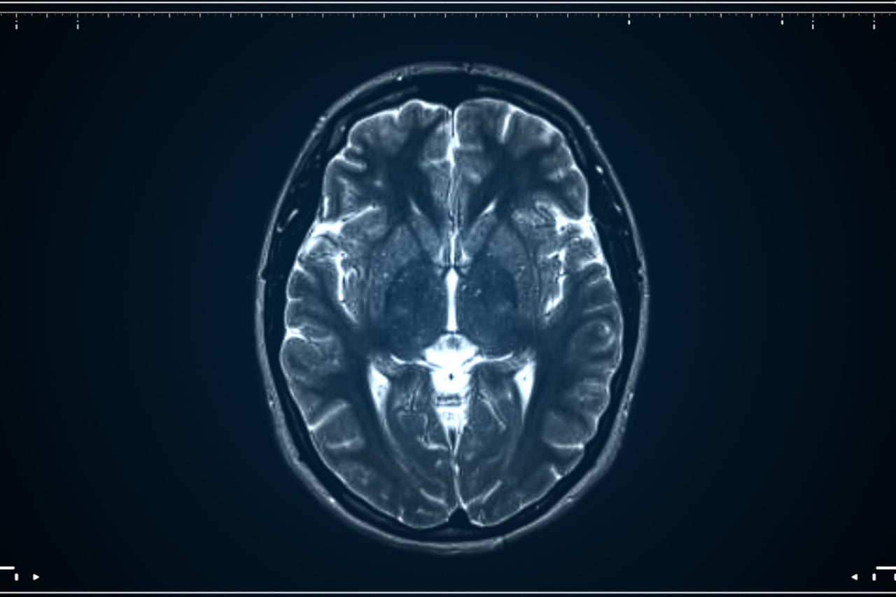 Human brain is actually two separate organs, scientists find - AOL