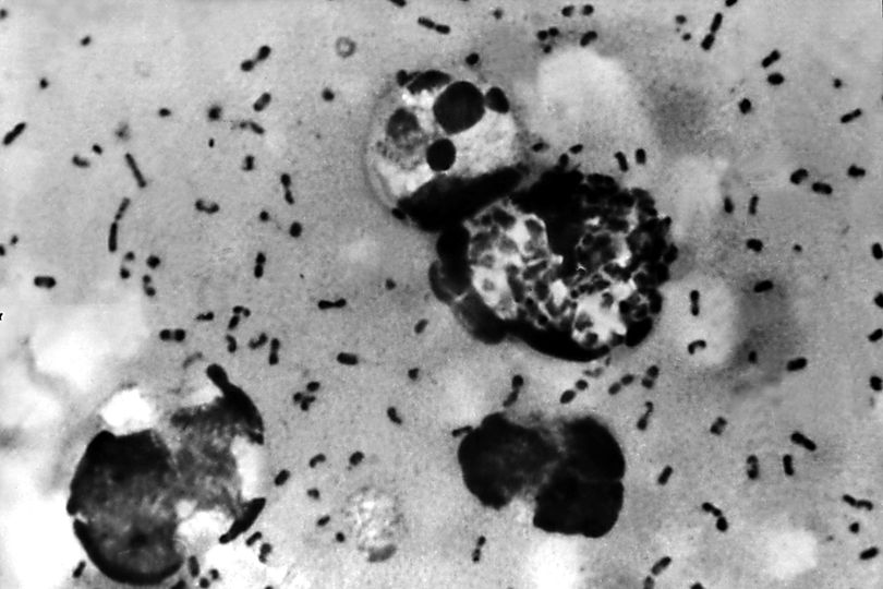 CDC issues urgent health notice on plague outbreak after death of lab