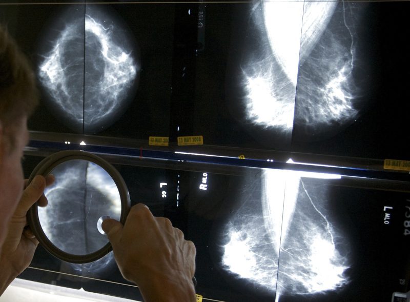 UConn Health emphasizes importance of early screenings for National ...