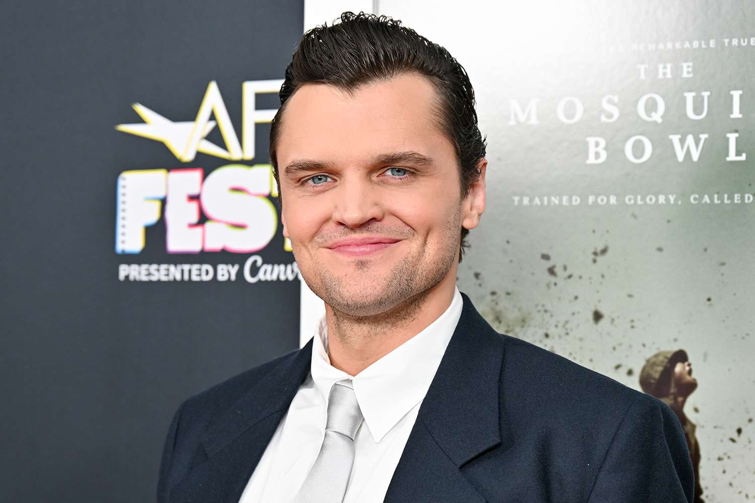 Ray Nicholson Had Knee Surgery After an Injury on Set and Returned to Filming the Next Day: ‘There Was a Hole' (Exclusive)