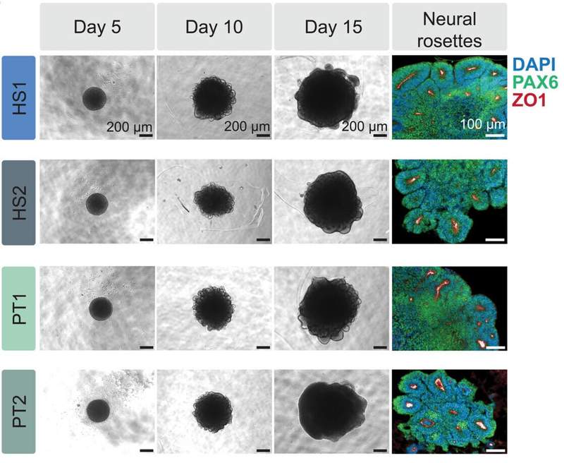 Dna And Humam Ancient viral DNA offers clues to why human and chimpanzee brains ...