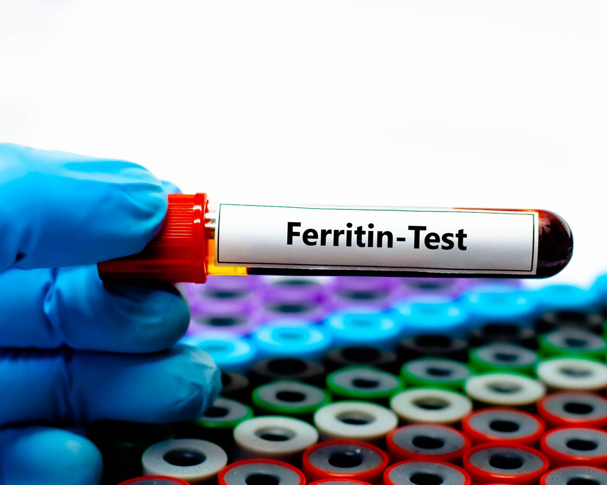 ‘Ferritin face': are social media claims about iron deficiency fact – or fiction?