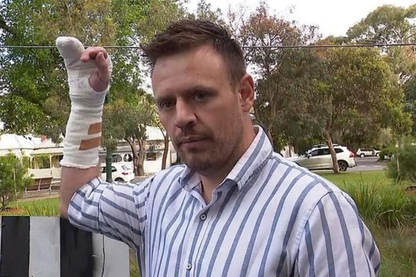 At Hand Father-of-three left with broken hand after fighting off home intruder ...